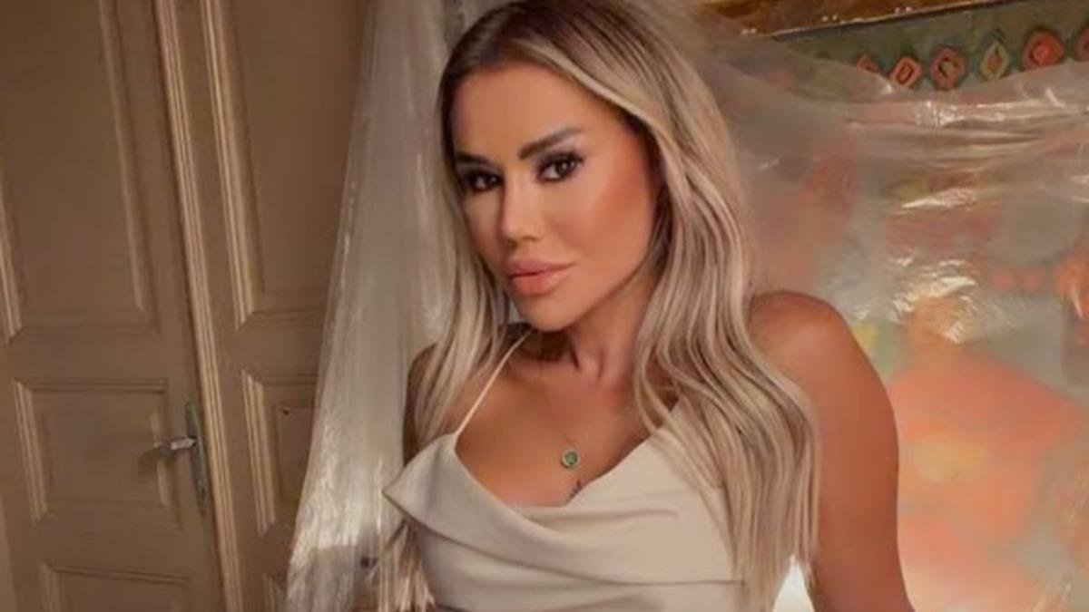 Ceylan'ın Estetik Açıklamasıyla Değişimi Dikkat Çekti!